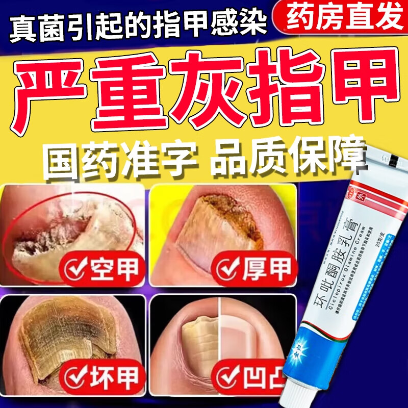 灰指甲专用药指甲真菌感染脱甲坏甲脚趾甲发黄变厚变空真菌感染 环吡