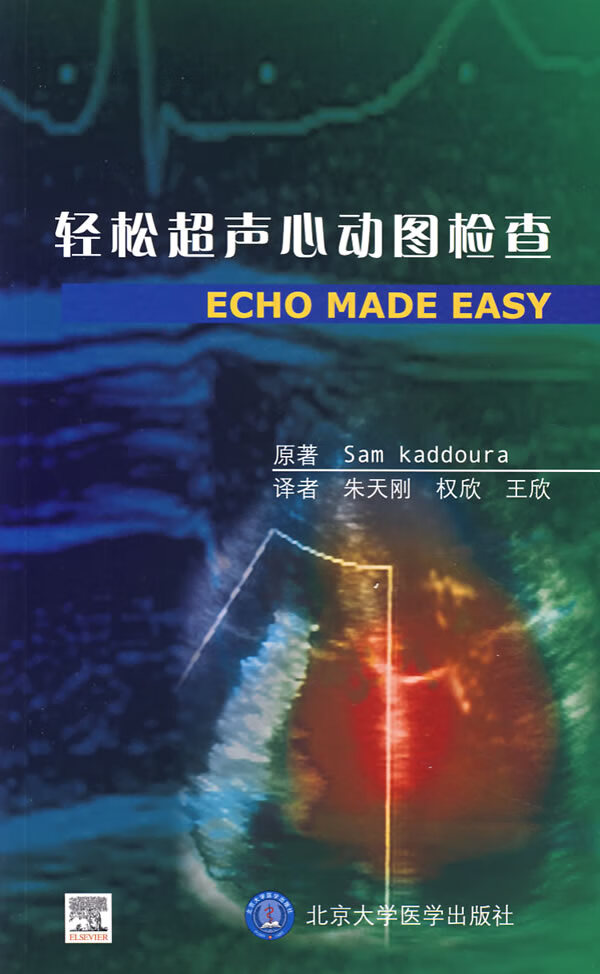轻松超声心动图检查