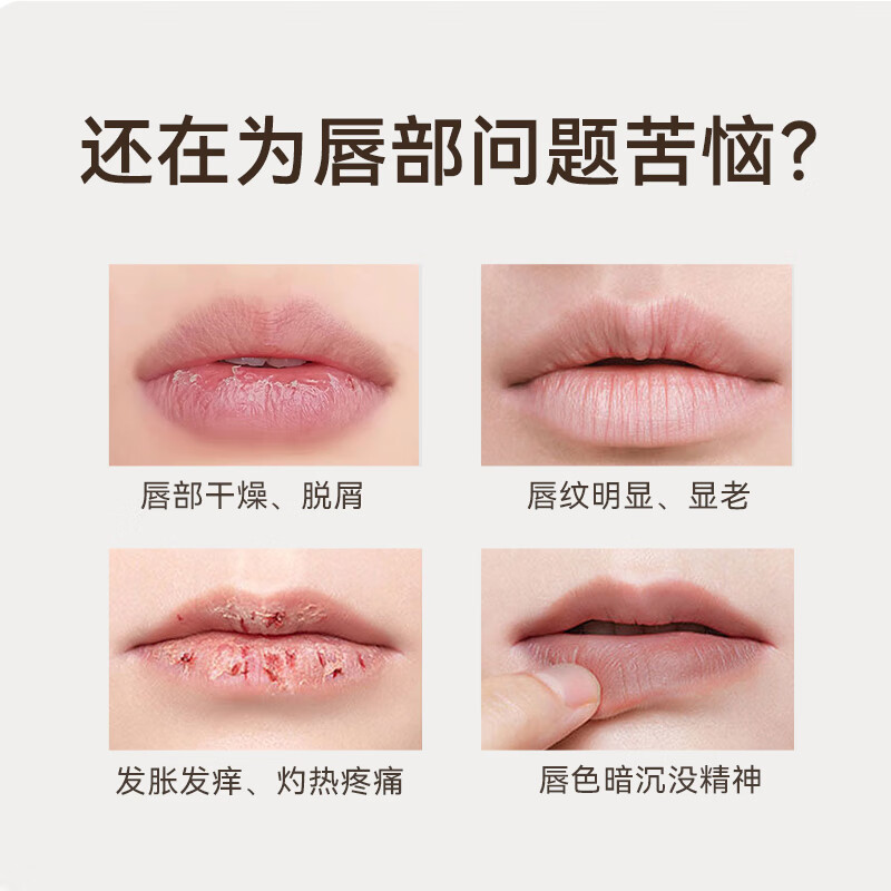 净舟三草油唇膏唇炎医去用去死皮保湿非药专用慢性唇炎嘴唇干裂 【护唇创新配方】 8g 常规装