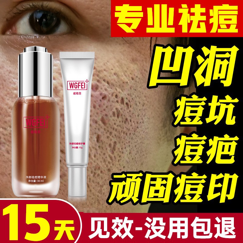 探究三联生活压力监测手环的价格走势及其影响因素