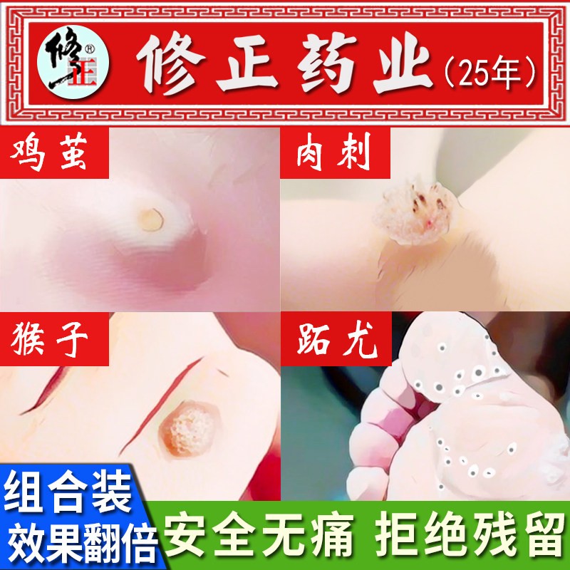 鸡眼膏十大品牌排行榜