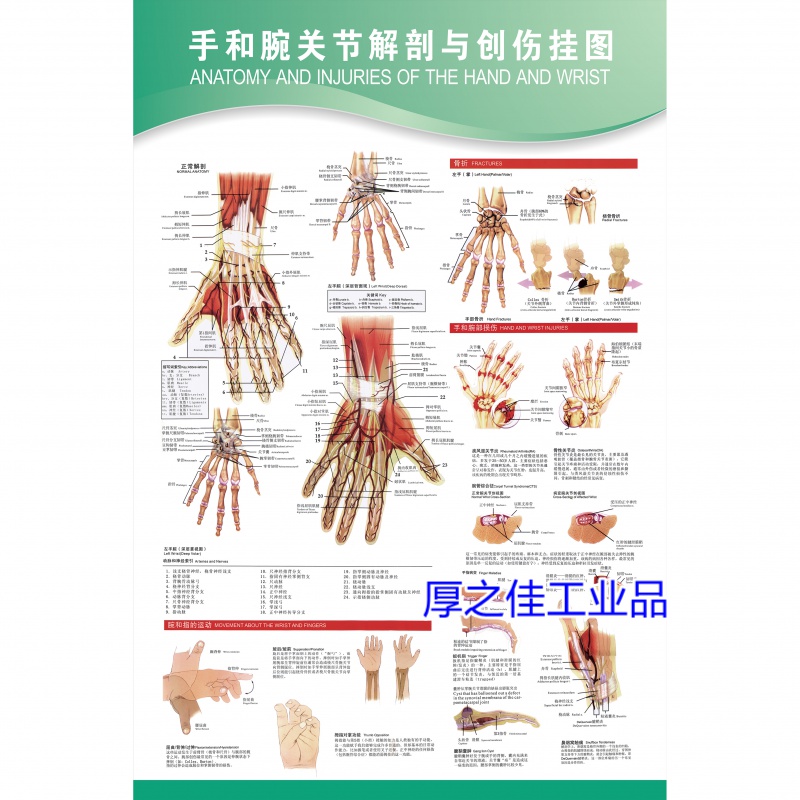定制适用手和腕关节解剖与运动损伤示意图骨骼肌肉示意图医院解剖海报
