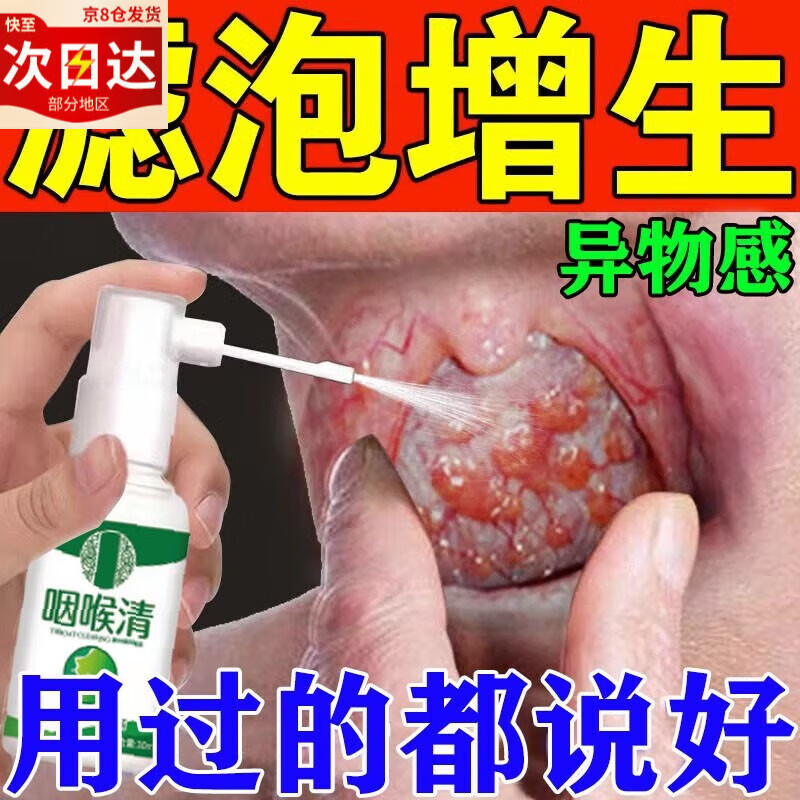 舌根淋巴滤泡增生慢性咽炎喉咙干痒干咳长泡咽喉肿痛异物感扁桃体 单