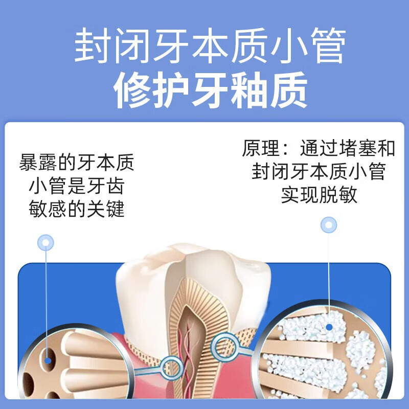 完好如初再生硅牙膏护龈亮白修护牙釉质不含氟抗脱敏感松动regesi儿童成人 护龈健齿正装1支【2支得儿童装】