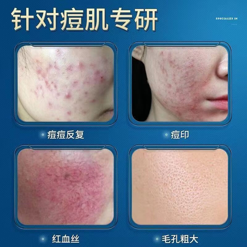 修正修护冻干粉【敏痘红】多肽修护紧致冻干粉敏感肌痘肌受损肌6瓶/盒 3盒【多肽紧致修护冻干粉】 6瓶/盒