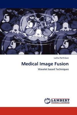 预订Medical Image Fusion