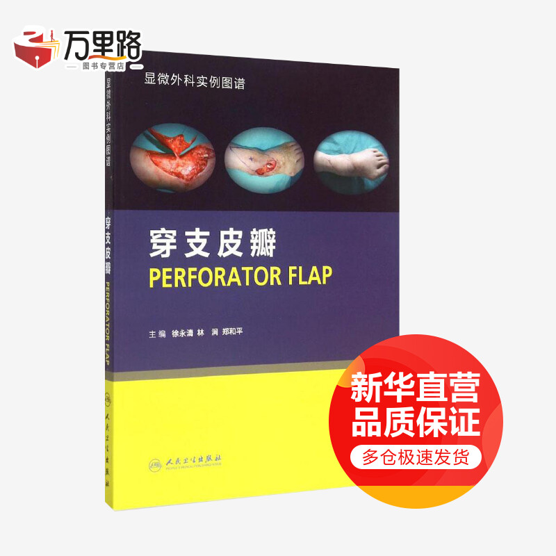 穿支皮瓣