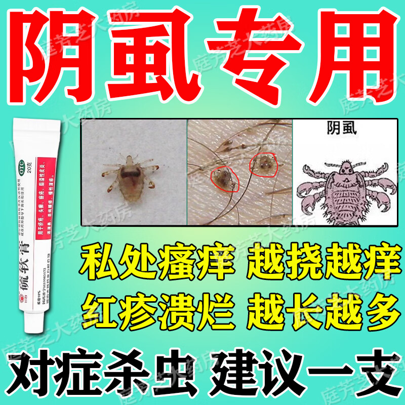 阴虱男私处阴虱专用药 去阴虱药膏治男女私处痒红疹溃烂半夜痒醒越挠