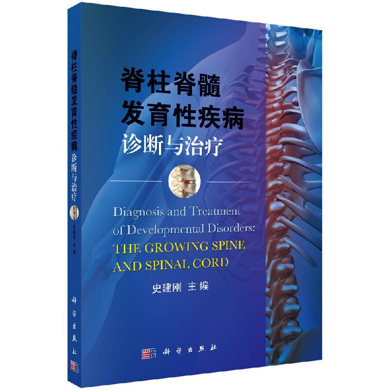 脊柱脊髓发育性疾病诊断与治疗  齿突发育畸形 齿突发育畸形 青少年特