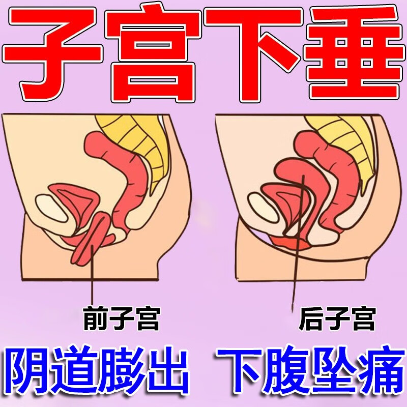 子宫下垂提升缓解贴子宫托脱落壁膨出小腹坠胀中老年下坠专用中草 单