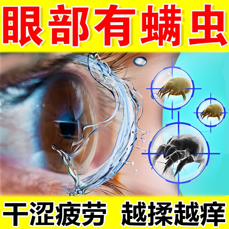 眼睛除螨虫药 盐酸金霉素眼膏螨虫药膏治疗眼部螨虫引起的发炎有异物