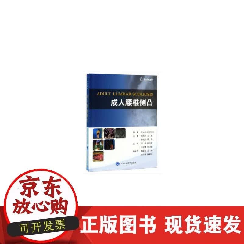 【正版现货】成人腰椎侧凸