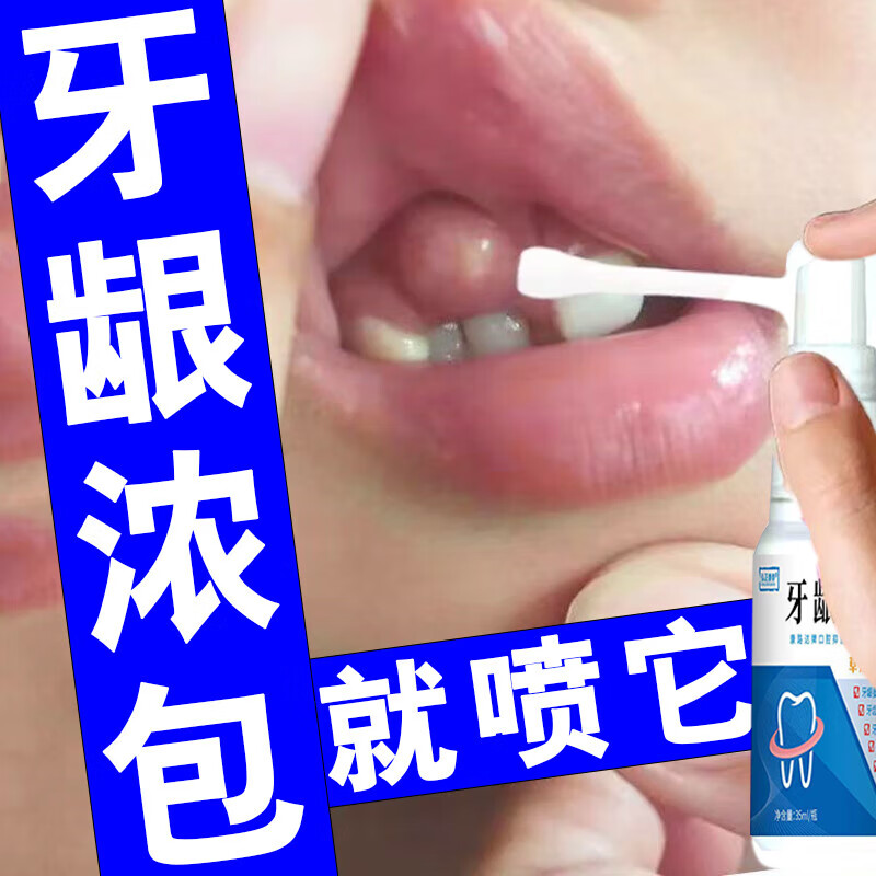 牙龈上长了个白色脓包图片