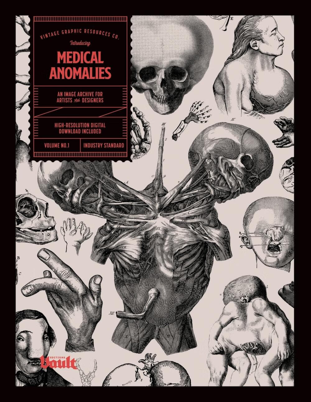 【预售 按需印刷】medical anomalies