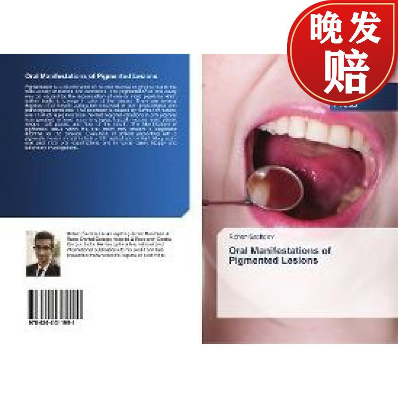 【4周达】oral manifestations of pigmented lesions