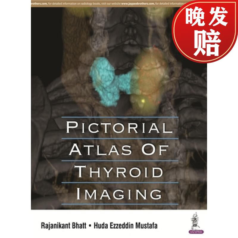 【4周达】pictorial atlas of thyroid imaging