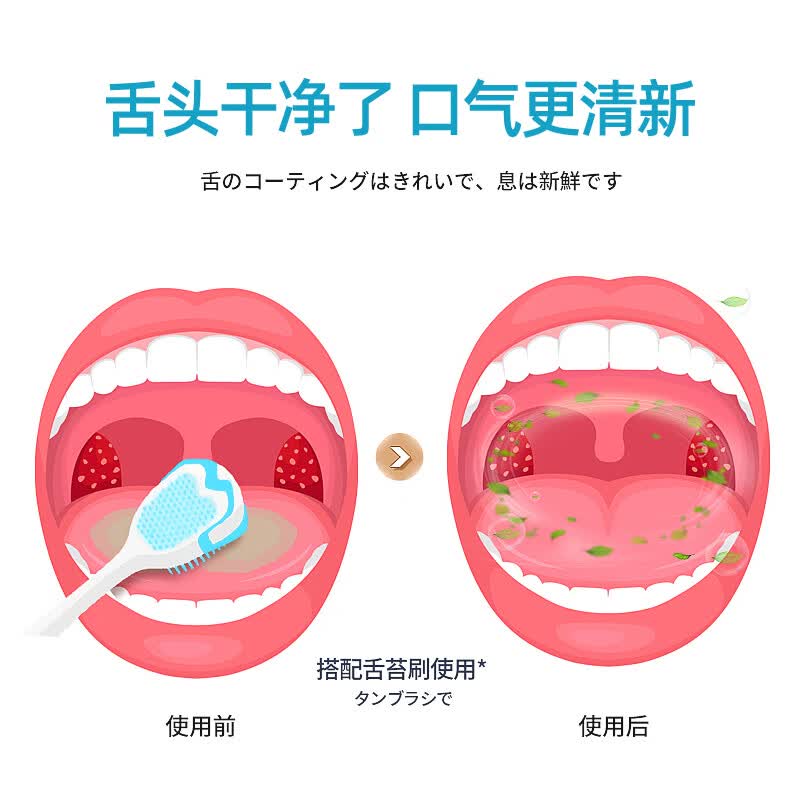 Sweetrip日本舌苔刷成人 舌苔清洁器舌苔刷神器 清新口气啫喱刮舌板 日本舌苔刷 2支装 颜色随机