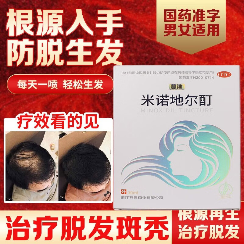 米诺地尔酊5%浓度蔓迪男女性防脱育发液药发际线生长增发斑秃搽剂凝胶
