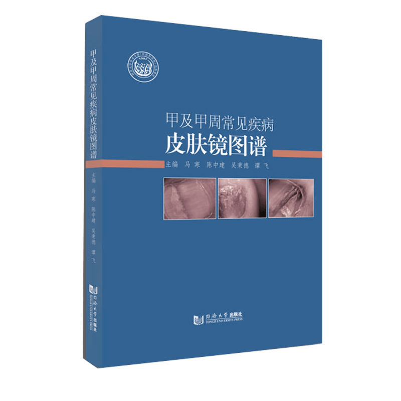 甲及甲周常见疾病皮肤镜图谱 同济大学出版社预售