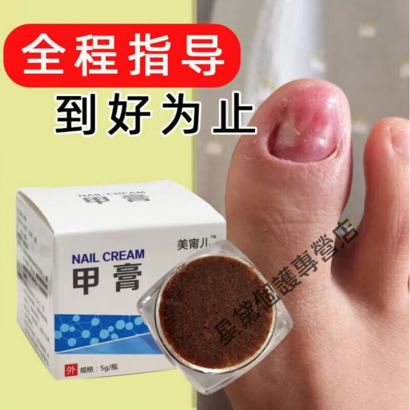 软甲膏修甲脱甲膏快速特孝软甲溶甲膏去厚甲灰甲净灰指甲增厚 脱甲膏