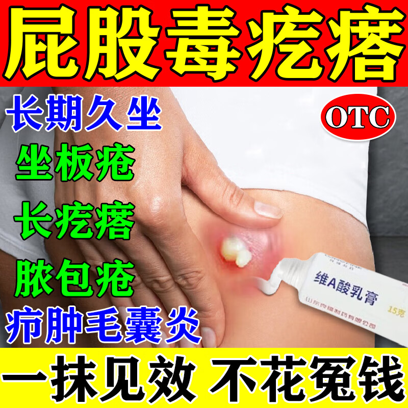 坐板疮药膏】火疖子专用药 屁股瘙痒久坐长毒疙瘩脓包痘拔脓毒消硬块