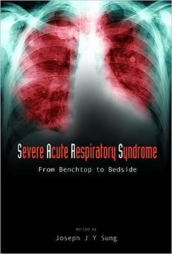预订 severe acute respiratory syndrome (sars): from benchtop to
