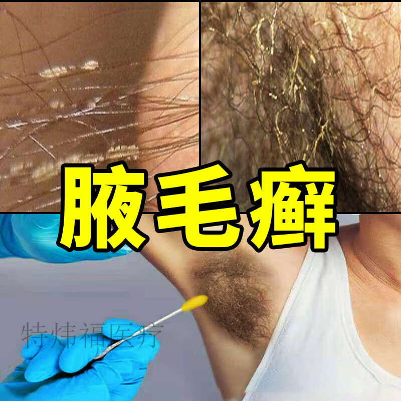 【京健康】腋毛癬腋毛廯腋下清洗液异味污垢出汗瘙痒晶体白色腋窝毛藓