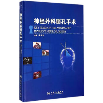 神经外科锁孔手术【放心选购】