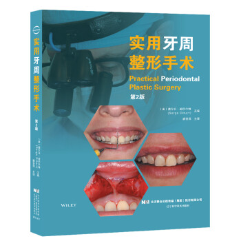 实用牙周整形手术 塞尔日·迪巴尔特 著【正版】