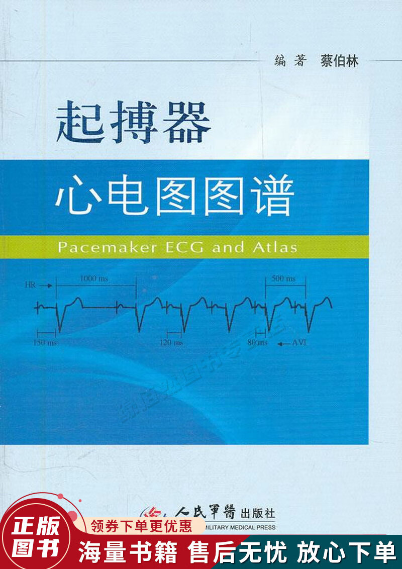 起搏器心电图图谱