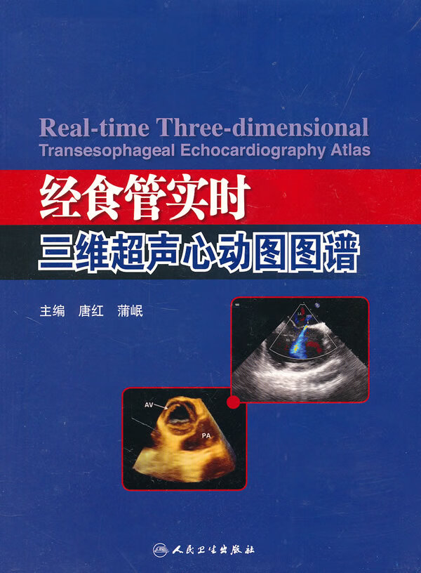正版图书 经食管实时三维超声心动图图谱 唐红 等 人民卫生出版社