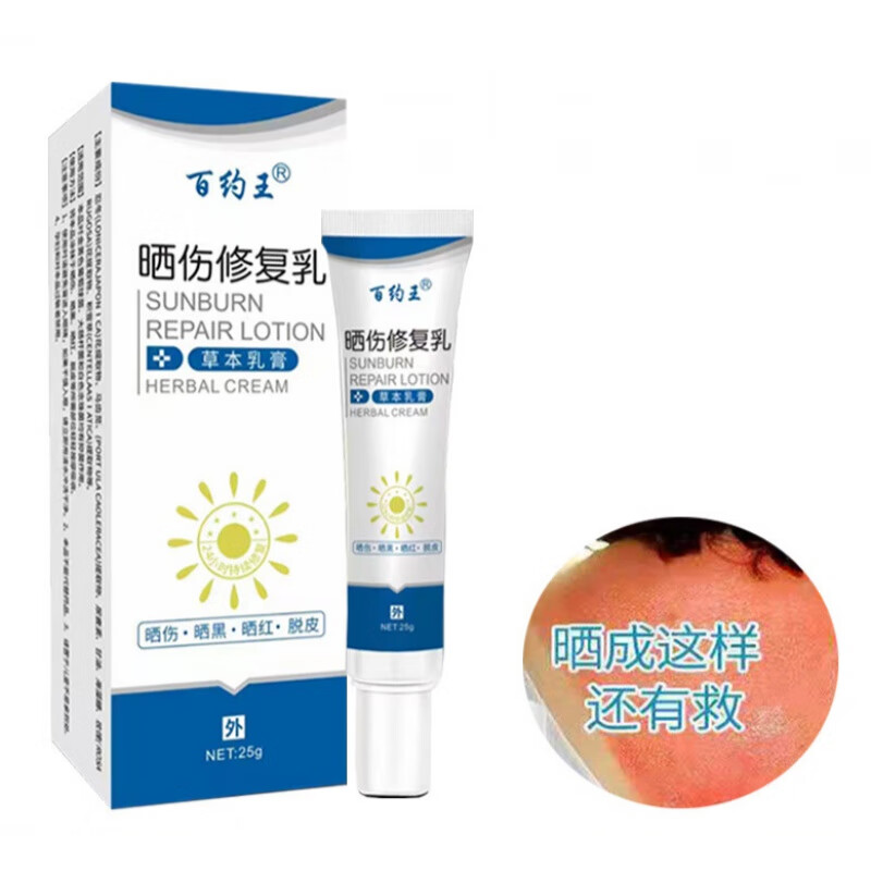 紫外线过敏太阳晒伤红痒脱皮日光性皮炎脖子晒红热痱子防晒修复膏