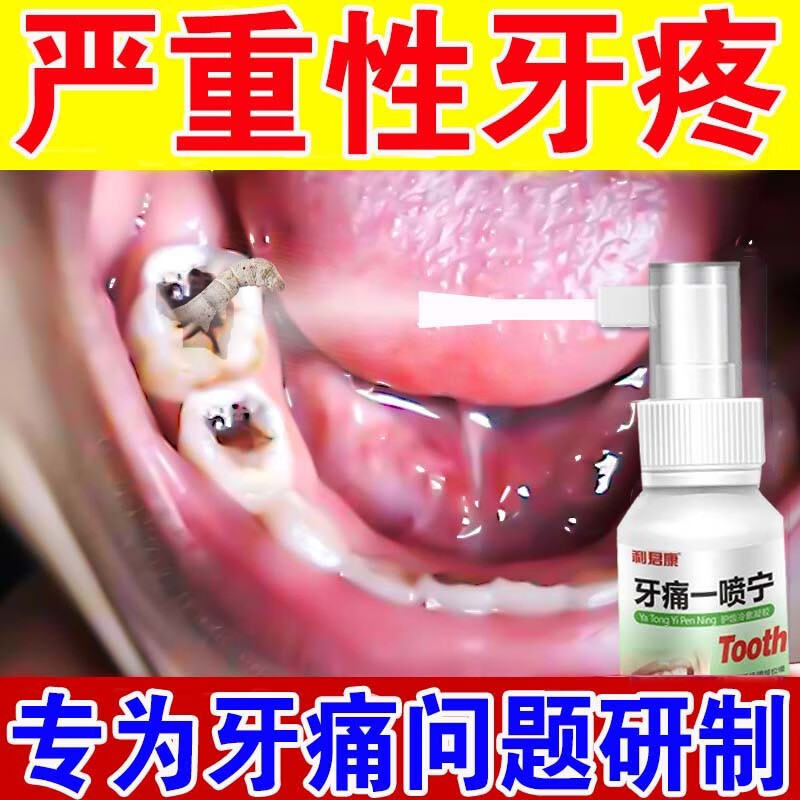 牙疼的药牙髓炎止神经痛水牙龈肿痛智齿发炎上火牙周炎喷剂 1盒装