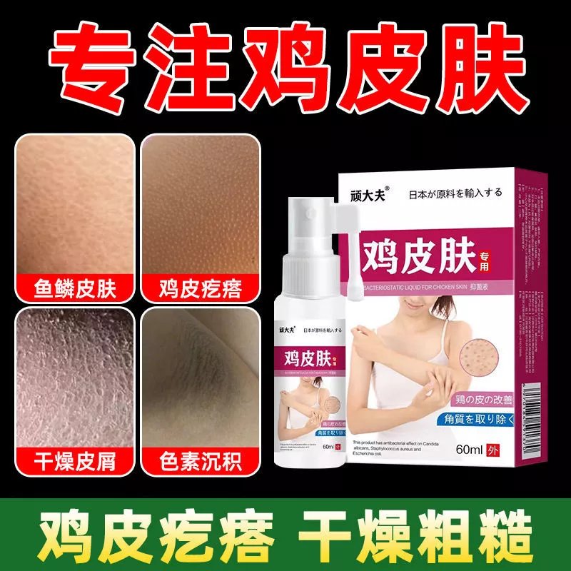 怎么去鱼鳞斑和鸡皮疙瘩(怎么去鱼鳞斑和鸡皮疙瘩的小妙招) 怎么去鱼鳞斑和鸡皮疙瘩(怎么去鱼鳞斑和鸡皮疙瘩的小妙招)