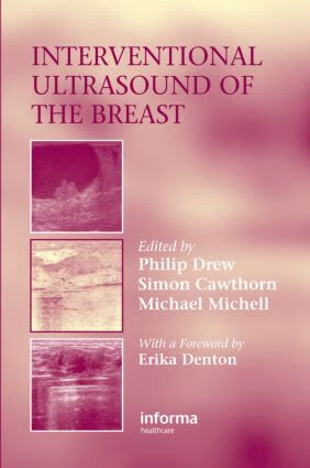 预订 interventional ultrasound of the breast