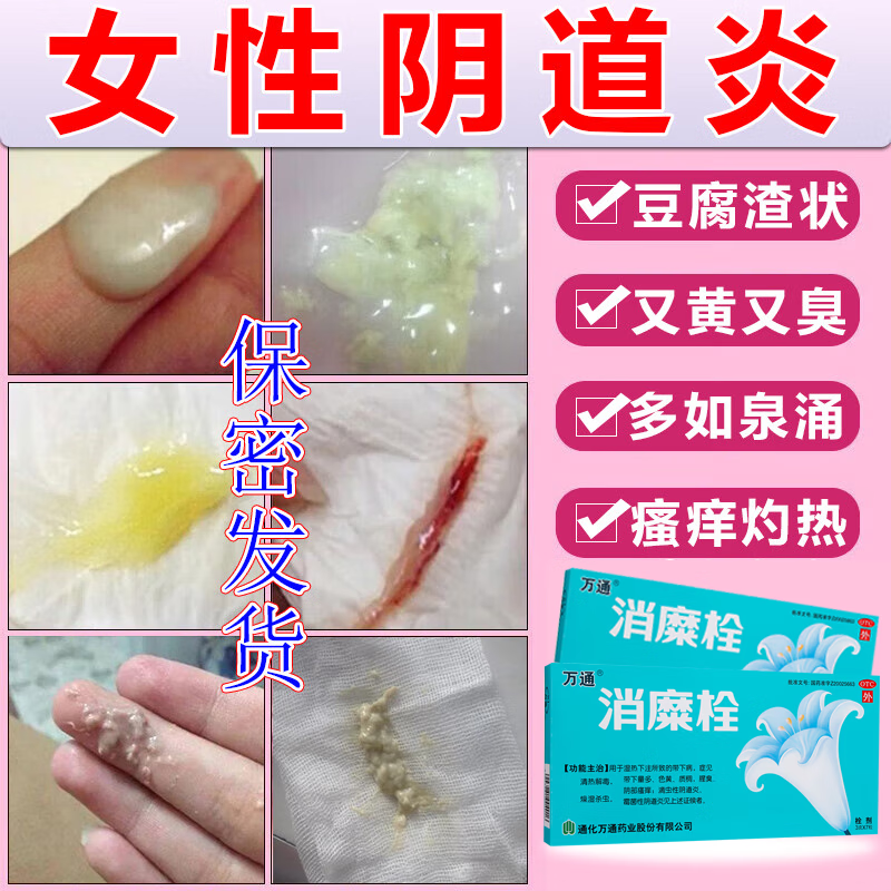 治多种妇科炎症霉菌性阴炎内用药妇科外阴瘙痒专用宫颈糜烂妇科用药二