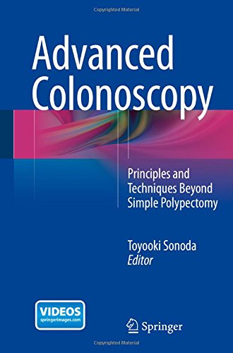 预订 advanced colonoscopy