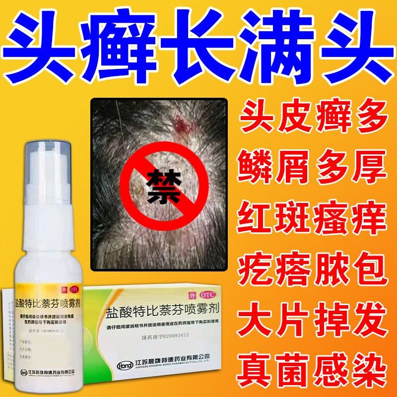 炎头皮痒脂溢性皮炎掉皮屑红斑磷癣黄癣白癣头癣药盐酸特比萘芬喷雾剂