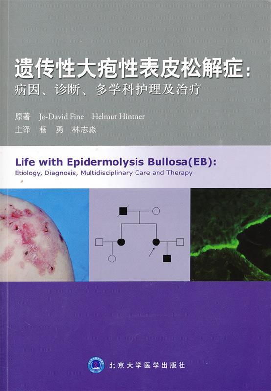 遗传性大疱性表皮松解症:病因、诊断、多学科护理及治疗 (美)费恩,(奥)欣特纳著,杨勇,林志淼主