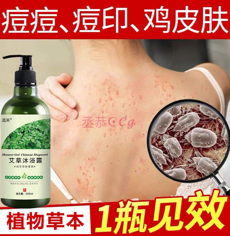 去鸡皮肤沐浴露鸡皮疙瘩（皮肤不好有鸡皮疙瘩用什么沐浴露）