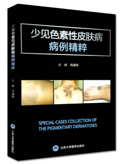 包邮 少见色素性皮肤病病例精粹 常建民 编 北京大学医学出版社