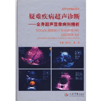 疑难疾病超声诊断 全身超声显像病例精析【放心选购】