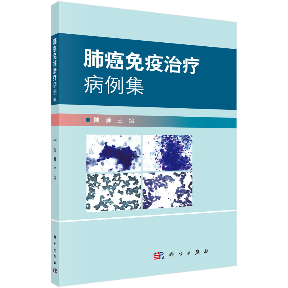 [正版图书]肺癌免疫治疗病例集