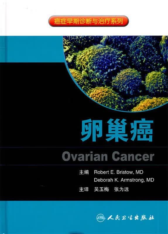卵巢癌