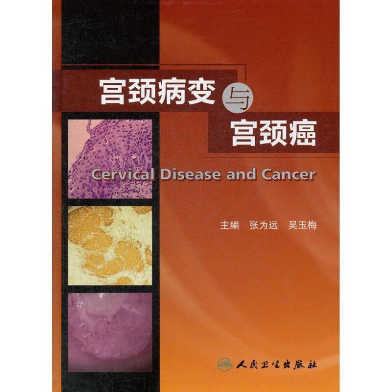 宫颈病变与宫颈癌 张为远 等主编【正版】