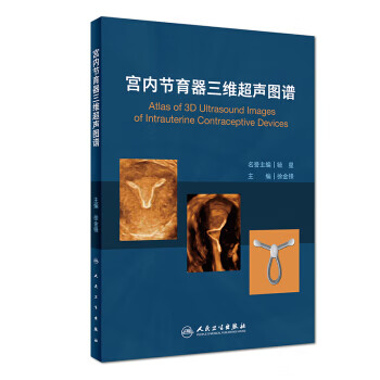 宫内节育器三维超声图谱【正版图书】