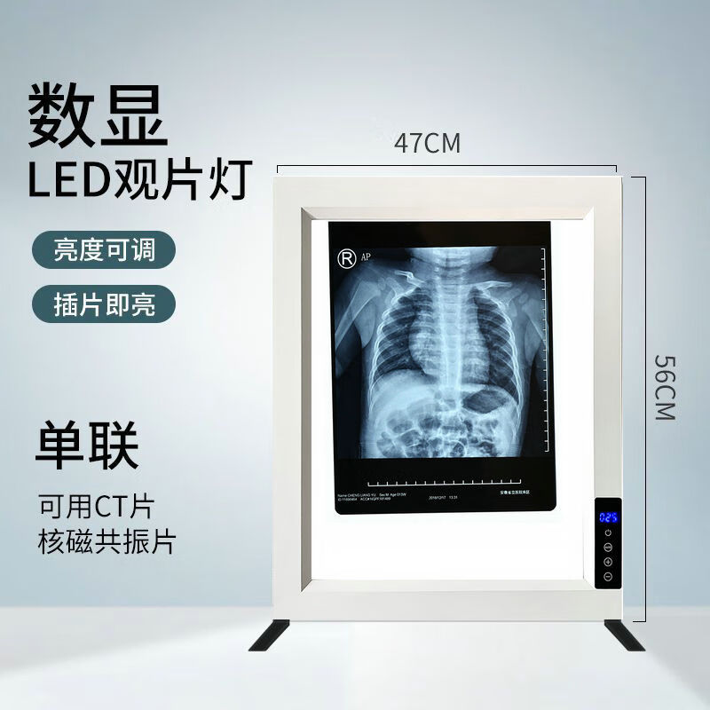 医用观片灯箱铝合金  x射线胶片观片灯看x光阅片骨科读片灯箱牙科单双