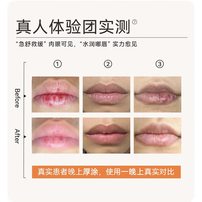 净舟三草油唇膏唇炎医去用去死皮保湿非药专用慢性唇炎嘴唇干裂 【护唇创新配方】 8g 常规装