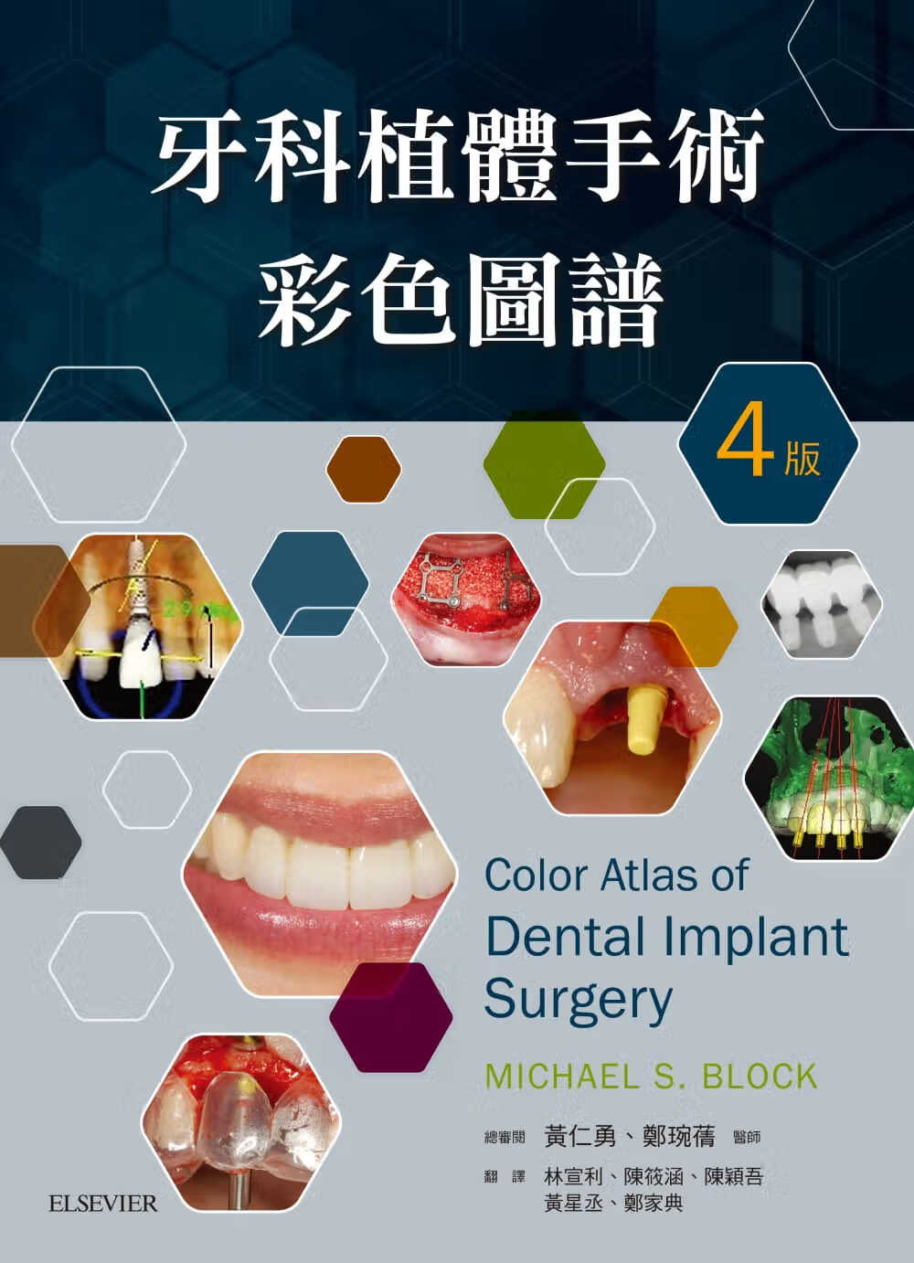 预售 Michael S. Block 牙科植体手术彩色图谱（4版） 中国台湾爱思唯尔