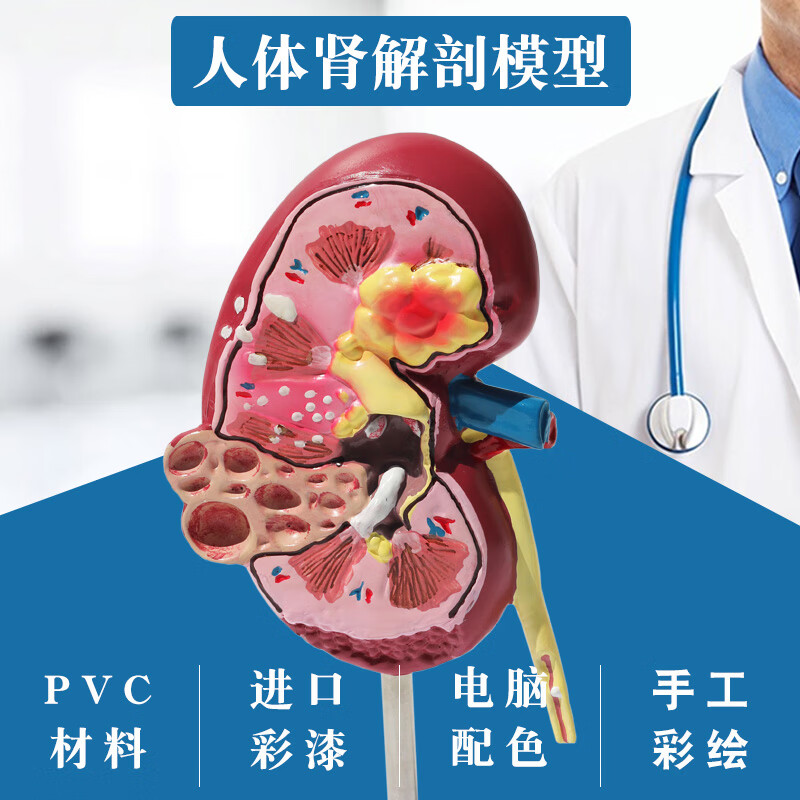 肾脏模型肾上腺模型肾单位肾小球病理病态肾泌尿系统肾结构医用